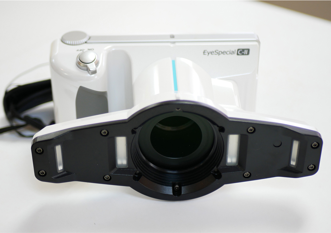 口腔内カメラ （一眼レフ・ペン）